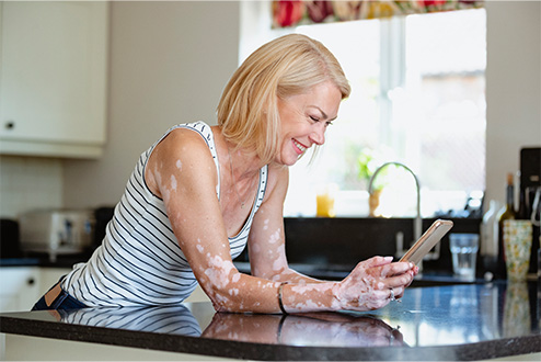 Representación de una mujer con vitiligo: Estudios clínicos de Pfizer